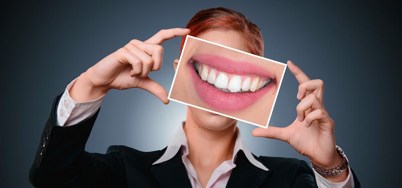 You are currently viewing Zähne richtig pflegen und gesund halten – das gibt es zu beachten